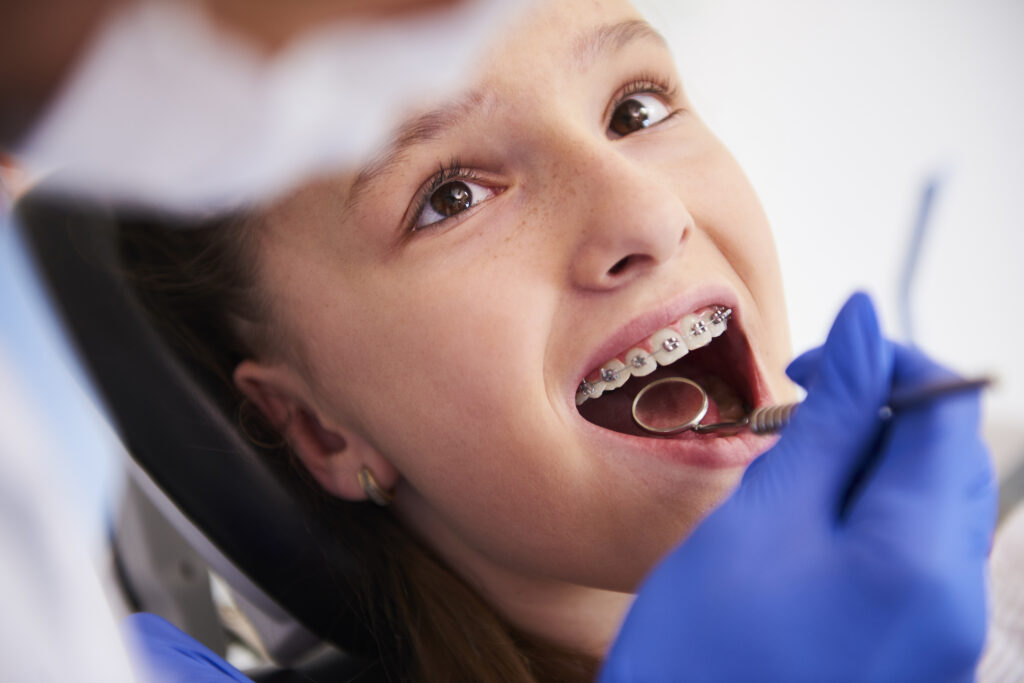 a girl checking her teeth -diamond braces referenceby freepik,com